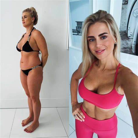 What Causes Cellulite in the Legs and How to Treat It | Cellulite Slayer