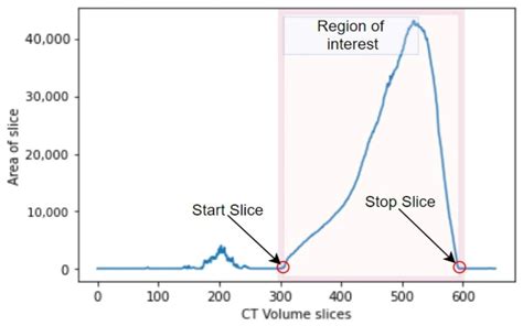 A Lightweight Deep Learning Approach for Liver Segmentation