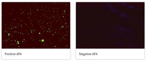 Image result for DFA Injective