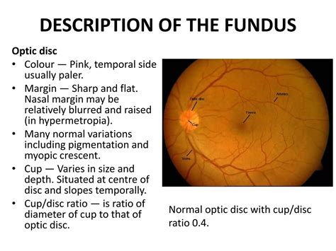The eyeball anatomy | PDF