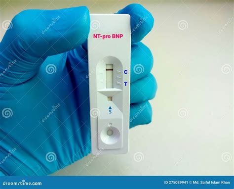 Scientist Hold a Test Device or Cassette for NT-pro BNP Test. Myocardial Infraction Stock Image ...