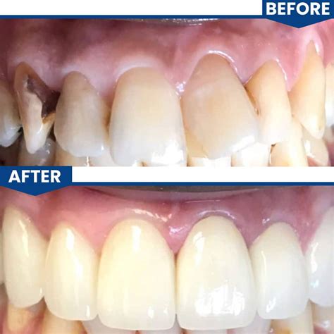 Smile Gallery | Central Valley Dentistry