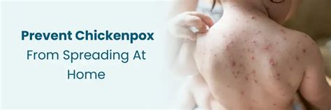 Chickenpox in Adults & Children: What to Know