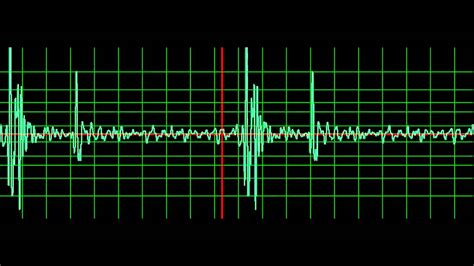 Computer Heart Beat Sound 的图像结果