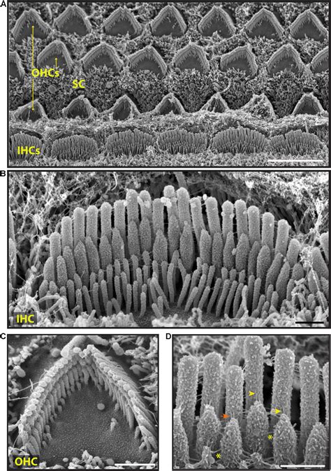 Image result for Electron Microscope Images