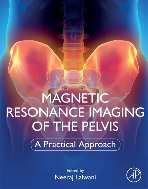 Buy Magnetic Resonance Imaging of The Pelvis: A Practical Approach Book ...