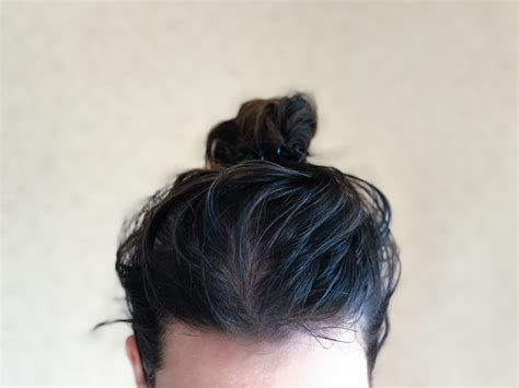 Greasy Hair Male at Kathy Morelli blog