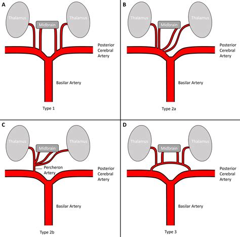 Paramedian Artery