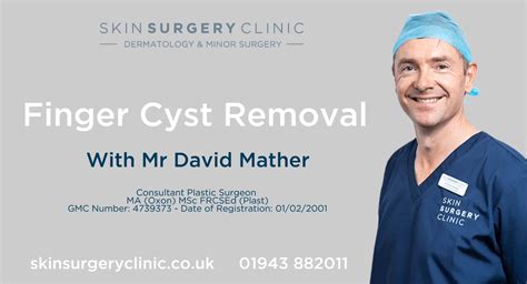 Ganglion Cyst Removal Videos - Treatment - Skin Surgery Clinic