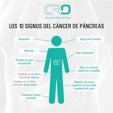 Cancer De Pancreas Sintomas Iniciales Cáncer Wikipedia, La