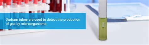 TM Media DURHAM TUBES Neutral glass, autoclave, Length:25mm-27mm ...