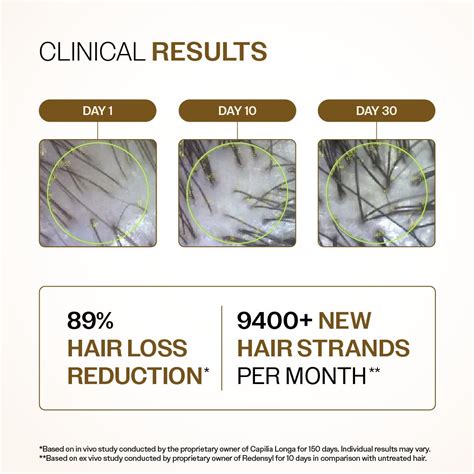 Hair Growth Serum with Redensyl, Rosemary & Rice Water | Bare Anatomy ...