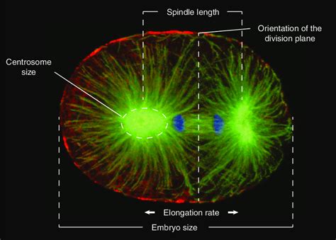 Spindle Def 的图像结果
