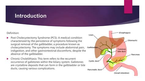 Post Cholecystectomy Syndrome and Chronic Cholelithiasis.pptx