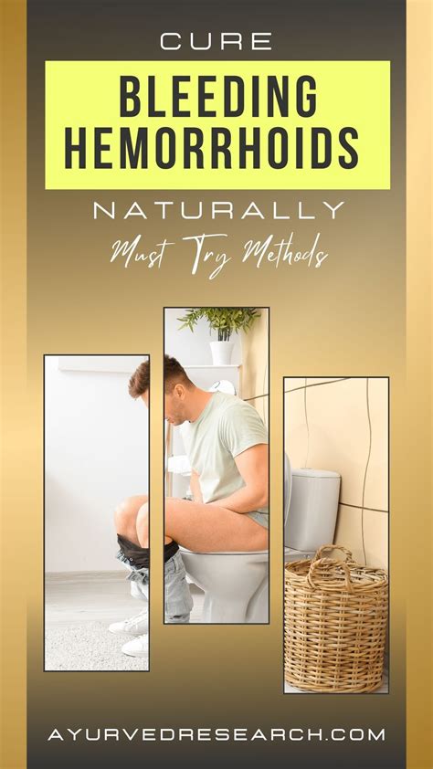 Best 13 Hemorrhoid Removal | Step by step – Artofit