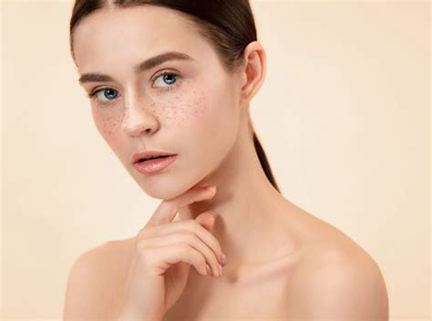 Image result for Freckles Using Self Tan