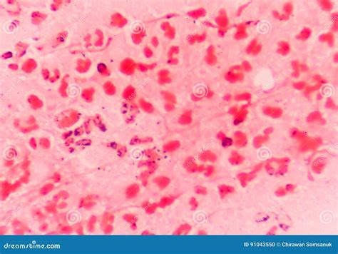 Gram Negative Diplococci Intracellular Stock Photo - Image of ...