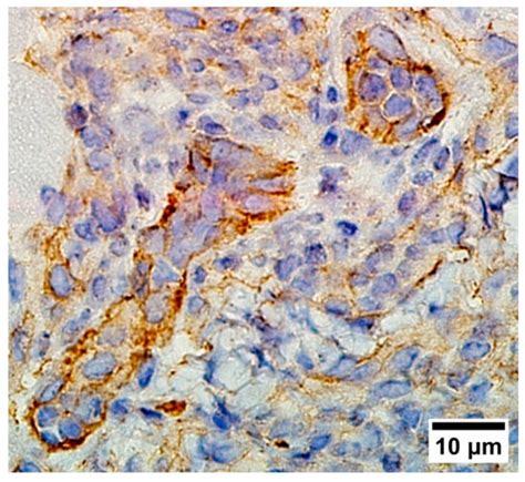 Polycationic Photosensitizers as Effective Anticancer Agents That ...