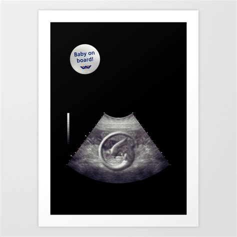 Image result for Alien Ultrasound