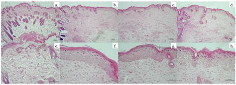 Anisotropic Silver Nanoparticles Gel Exhibits Antibacterial Action and ...