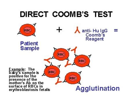 Image result for Define Coombs Test