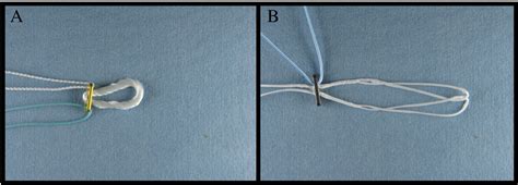 Image result for Transnasal Loop Fixation