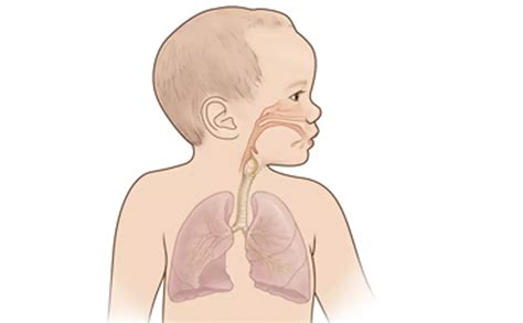 In Preterm babies, Lung ultrasound scores useful to predict ...