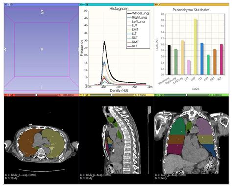 Different Lung Parenchyma Quantification Using Dissimilar Segmentation ...