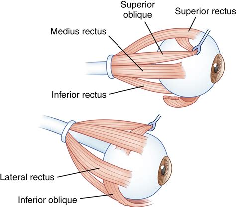 Neuro-ophthalmology: Ocular Motor System - Clinical Tree