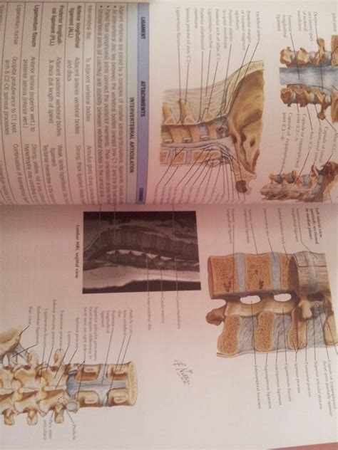 Bukumedik Blogspot (Medical Books Online Shoppe): Netter's Concise Orthopaedic Anatomy, 2nd ...