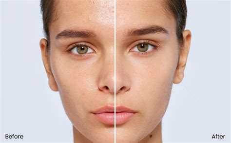 Buy (Orignal) DURVUDDI Kojic Acid Dark 2% with Niacinemide dark Spot ...