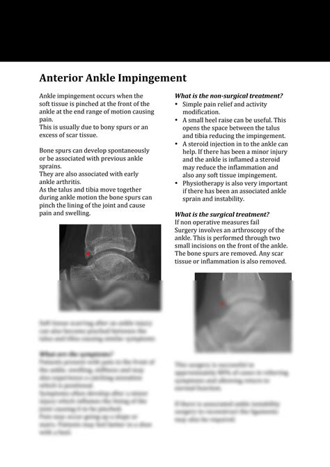 SOLUTION: What is Ankle impingement - Studypool