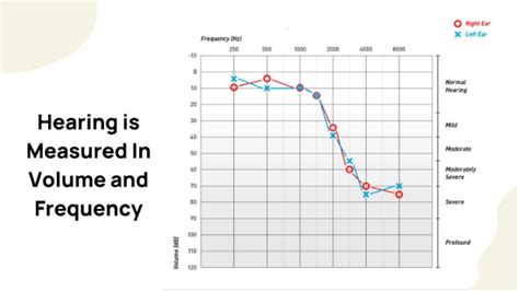 Audiogram Types and examples 的图像结果