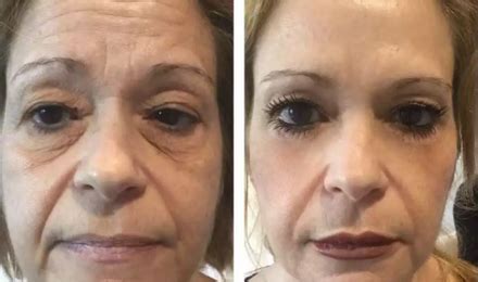 24K GOLD COLLAGEN BOOSTER SERUM – herbamore