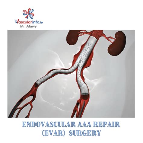 Which Endovascular Procedure Reopens Narrowed Blood Vessels