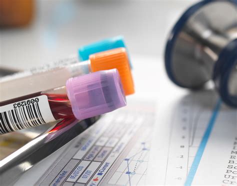 Lactate dehydrogenase test