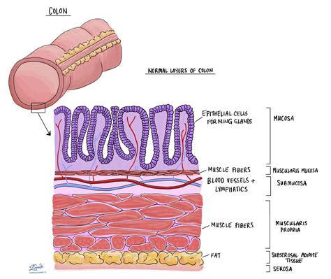 Colon | MyPathologyReport