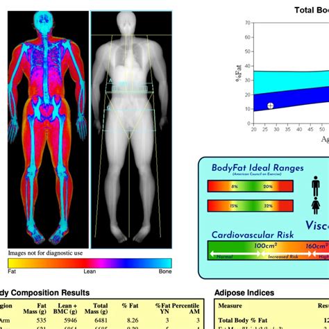 Image result for Dexa Scan Interpretation