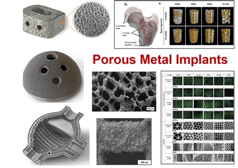 Porous