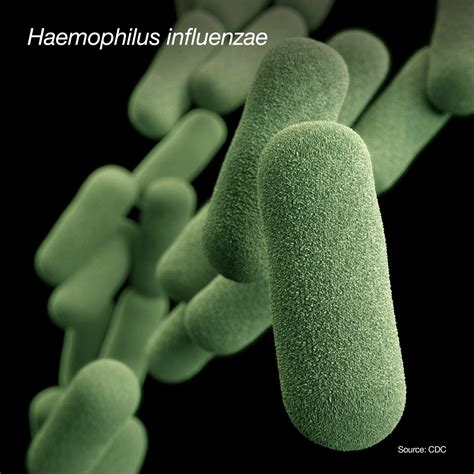 Haemophilus Influenzae Pneumonia