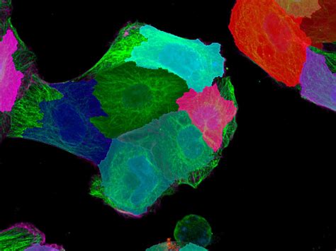 From Image to Results | High-content Screen for Cytoskeleton Regulation ...