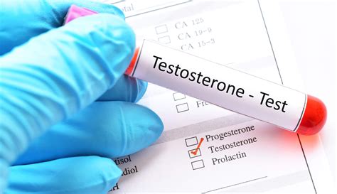 Testosterone Check 的图像结果
