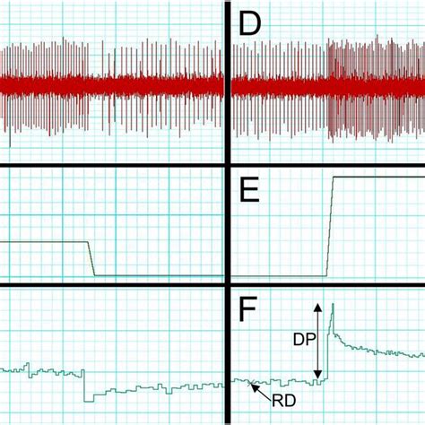 Image result for Muscle Spindle Rate Coding