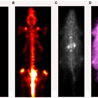 Image result for SPECT System Labeled