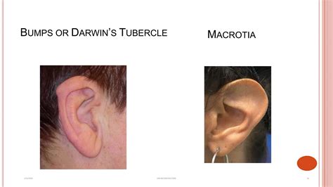 the ear structure.ppt