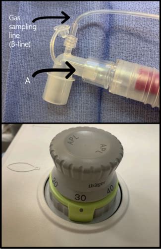 Image result for Anaesthesia Machine Check