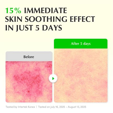 Buy EQQUALBERRY Aloe PDRN Calming Smoothie Serum – Soothing Korean Skin ...