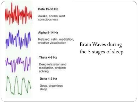 Sleep 的图像结果