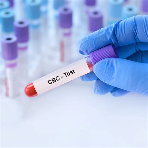 CBC Lab Panel 的图像结果