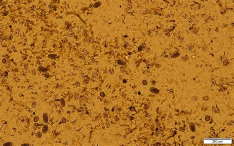 Coccidiosis in goats and sheep | OSU Small Ruminant Team